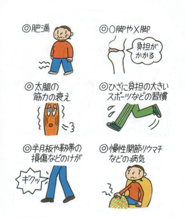 膝の痛み・変形性膝関節症のおもな要因