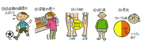 関節痛の主な原因