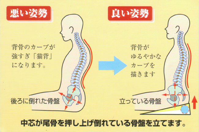 猫背矯正・猫背の原因