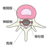 脊柱管狭窄症