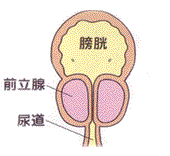 尿漏れ・前立腺肥大