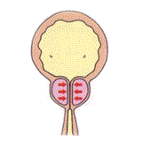 尿漏れ・前立腺肥大