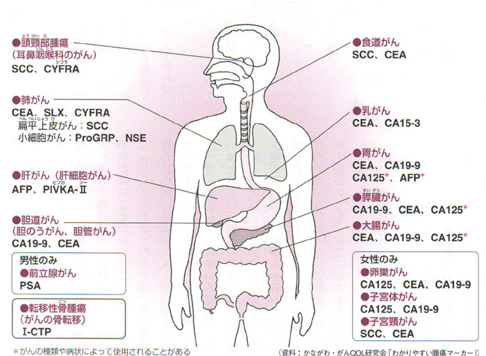 ガン検査に用いられる主な腫瘍マーカー
