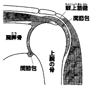 肩関節の炎症が痛みの原因