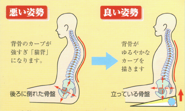 ぎっくり腰の原因・症状・対処法