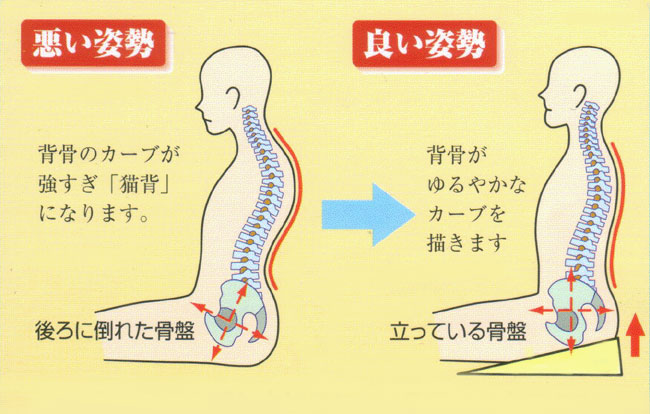 猫背矯正・猫背の原因