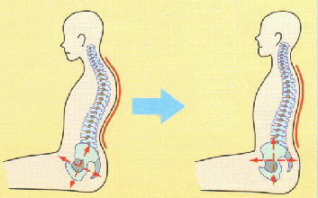 骨盤のゆがみを矯正する座り方