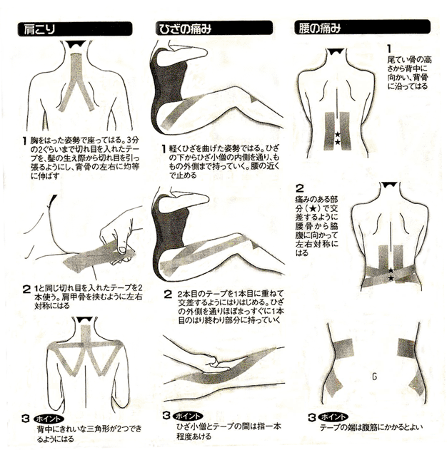 肩こりや腰痛の慢性的な症状緩和にテーピング はつらつライフ