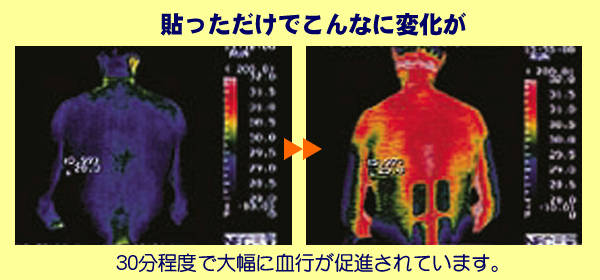 ゲルマテープ