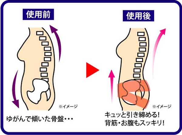 ダブル骨盤メッシュベルト